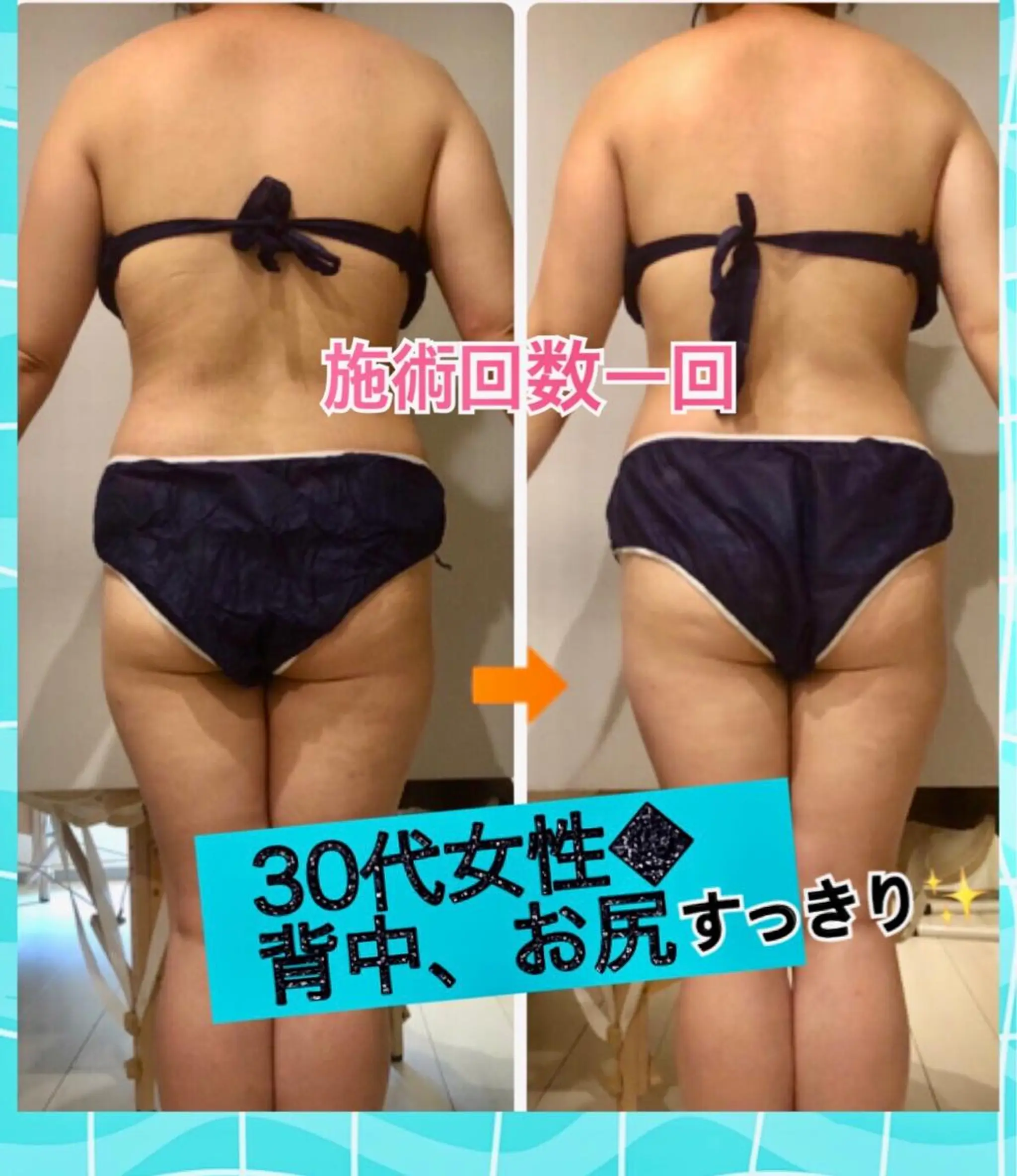 ロング カラー パーマ ヘアアレンジ メンズ キッズ ネイル マツエク・マツパ マットネイル ‍痩身＆ボディ 結果出し🌟丹野のエステ・リラクイメージ