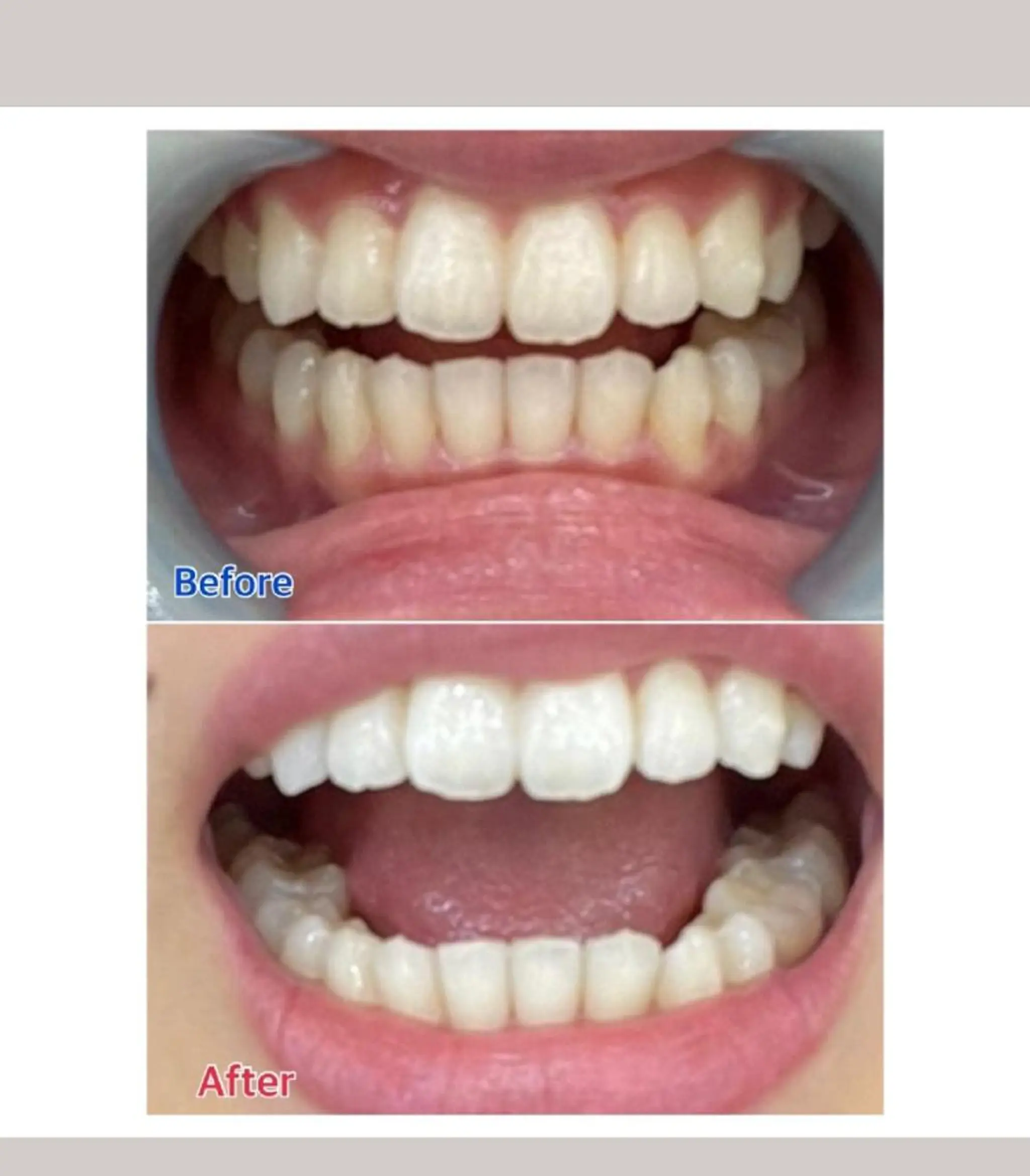 M渋谷店所属・M渋谷 ホワイトニングのエステ・リラクイメージ