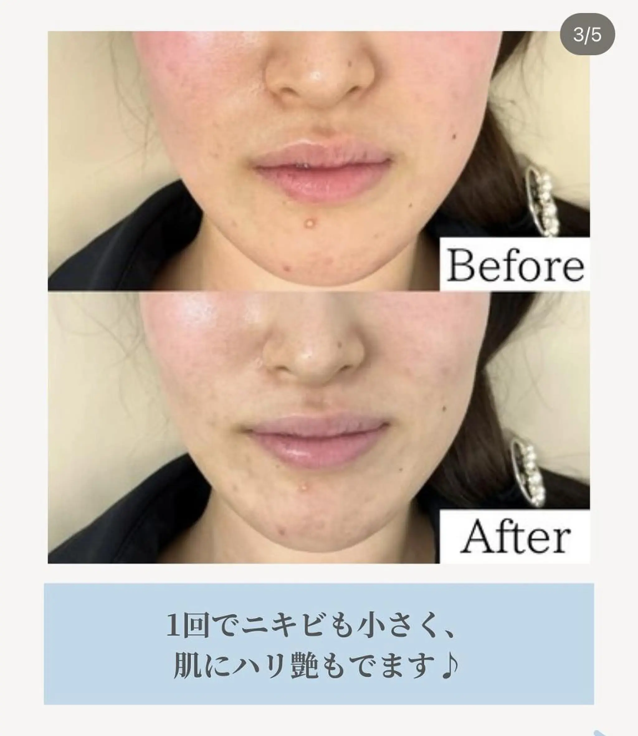 エステ JESSICA 吉祥寺のマツエク・マツパデザイン