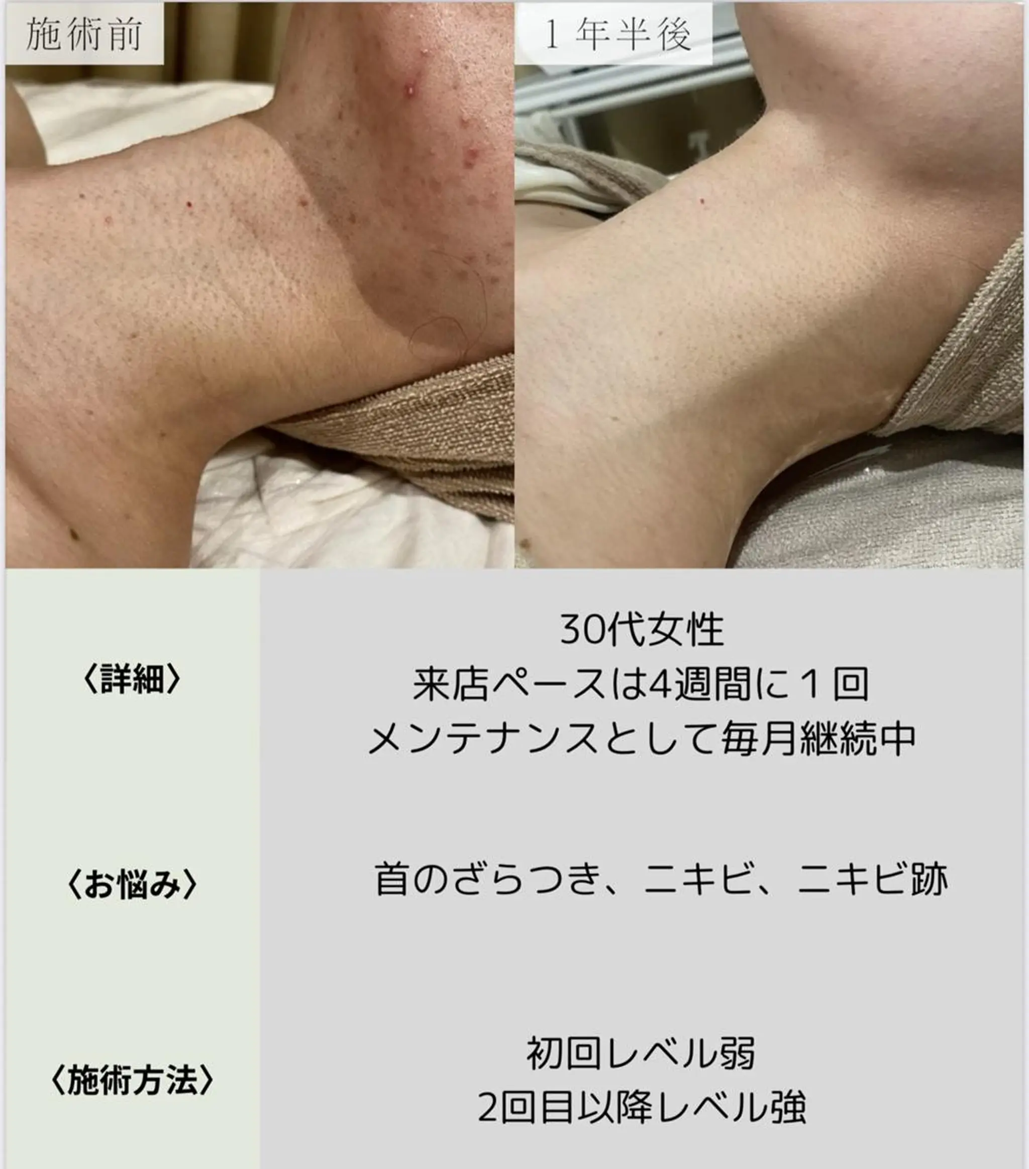 脱毛・眉毛・フェイス サロンN久留米店のその他イメージ