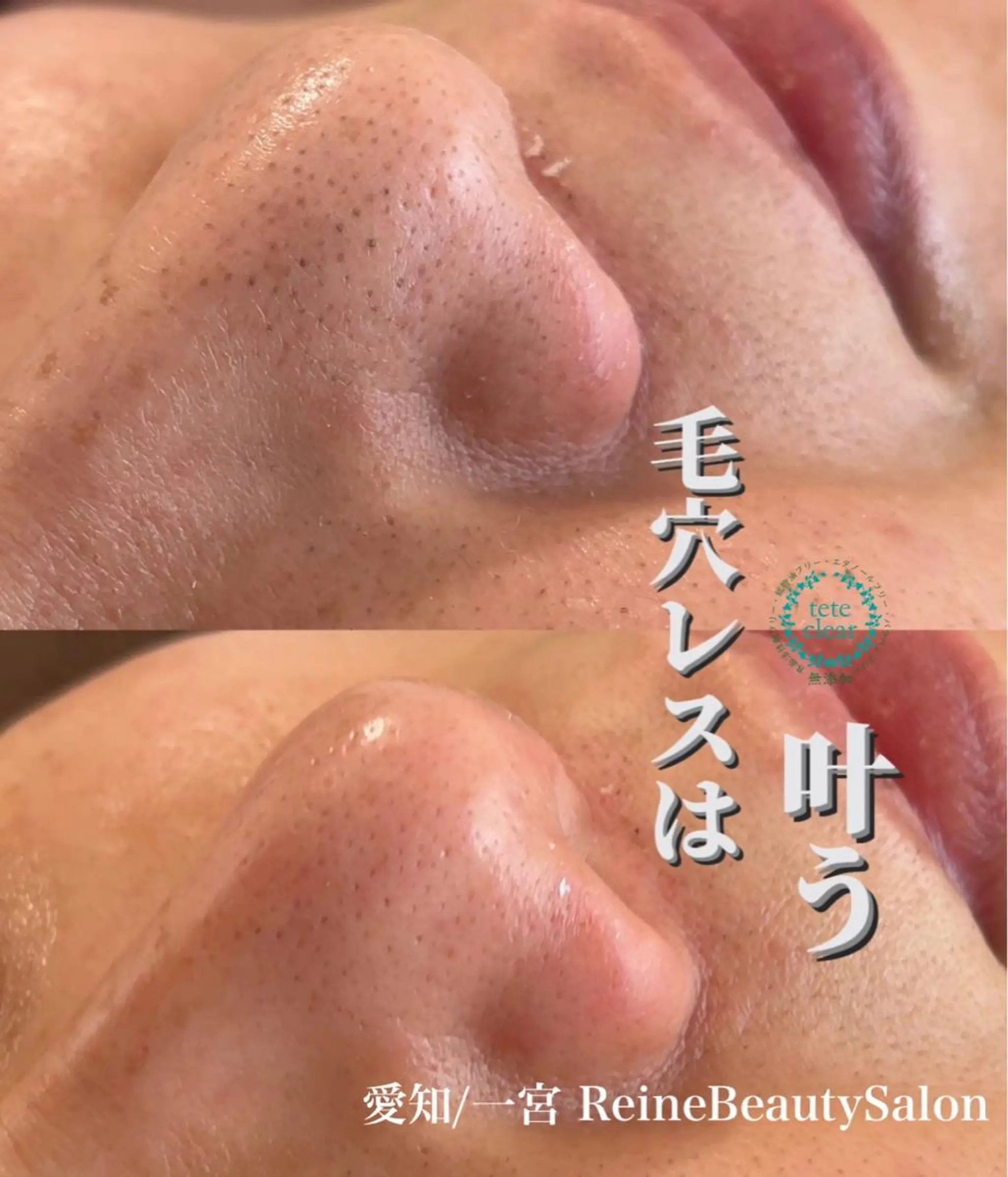 エステ Reine BeautySalon所属・毛穴/シミ肝斑/脱毛 横山梨里のエステ・リラクイメージ