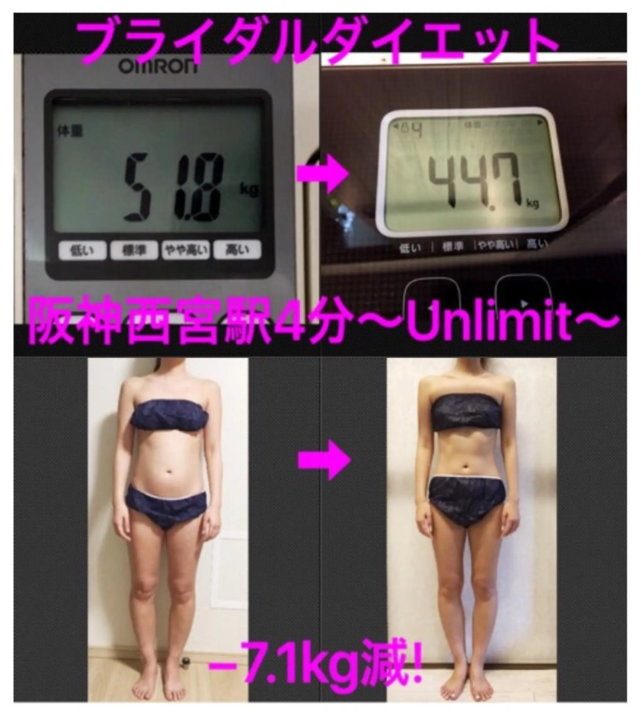 脱毛＆エステサロン【アンリミット】所属・森谷 莉美のエステ・リラクイメージ