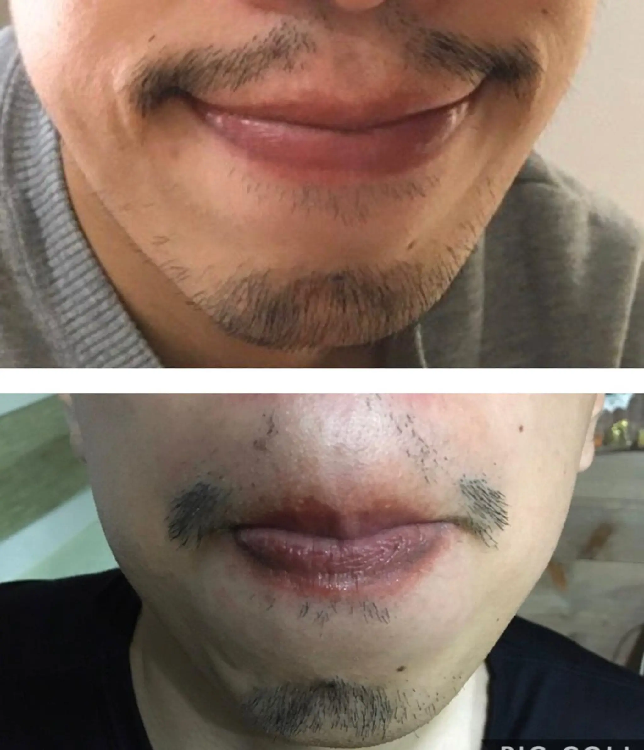 メンズ 脱毛＆エステサロン【アンリミット】所属・森谷 莉美のエステ・リラクイメージ