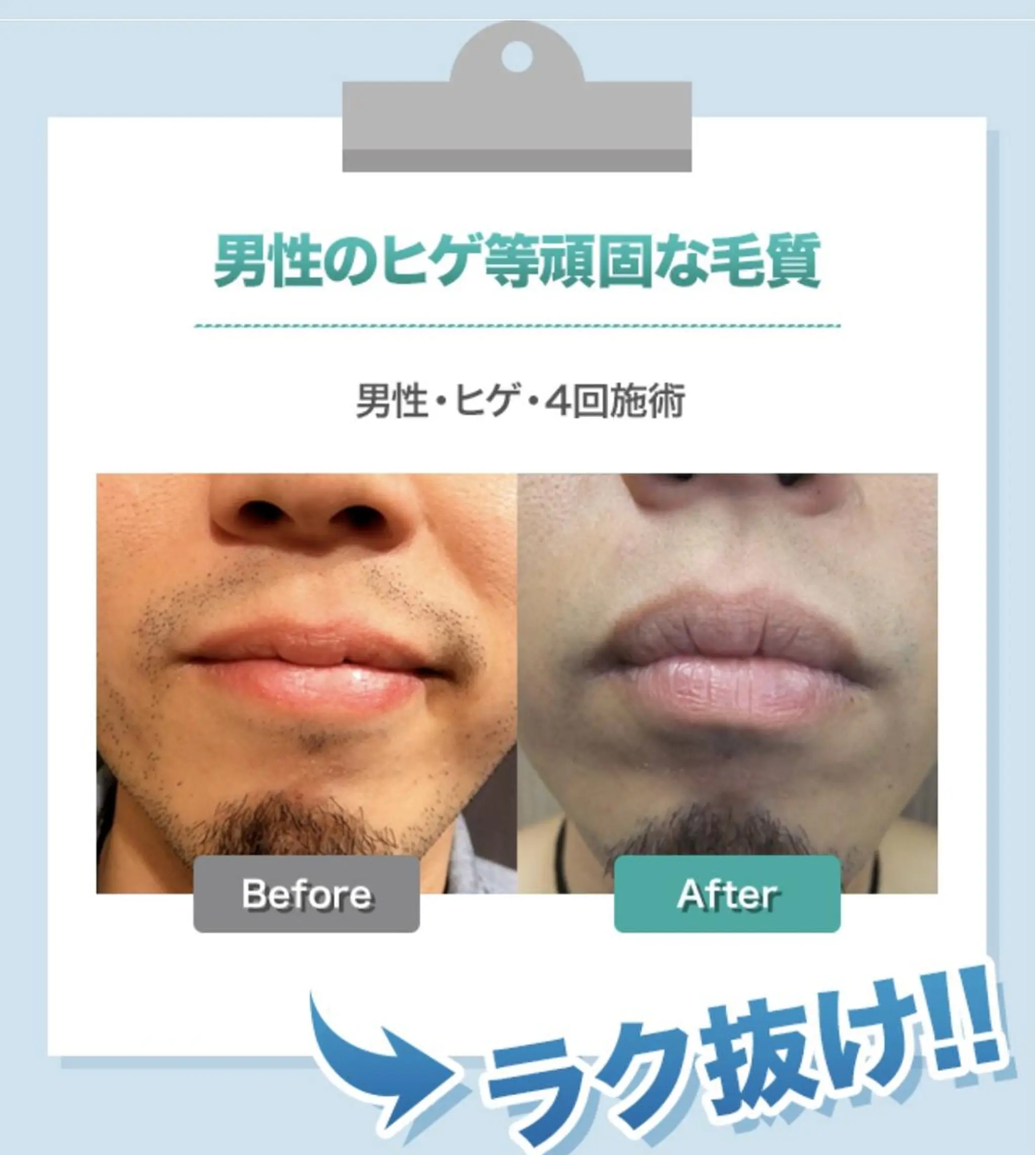 メンズ 脱毛サロン y0uのエステ・リラクイメージ