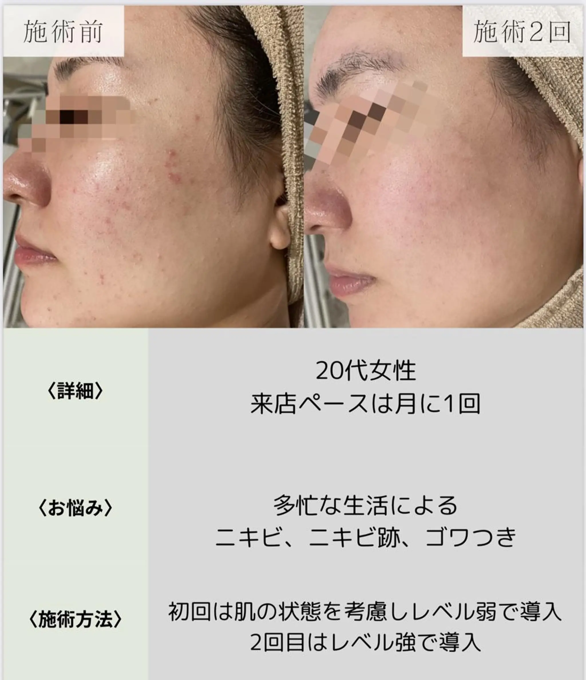 脱毛・眉毛・フェイス サロンN久留米店のその他イメージ