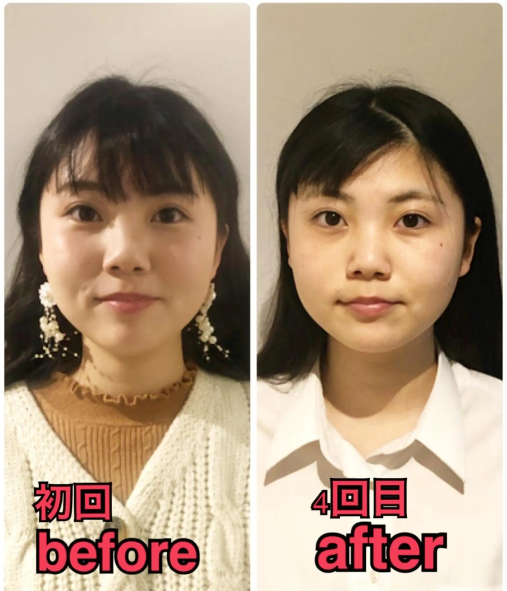 小顔矯正専門サロンジュマリ所属・町田 淳子のエステ・リラクイメージ