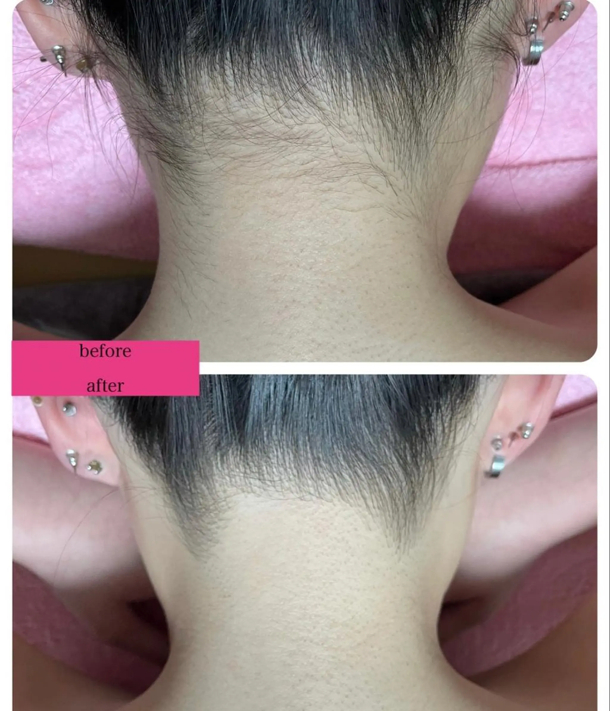 脱毛 self salon ～輪～のその他イメージ