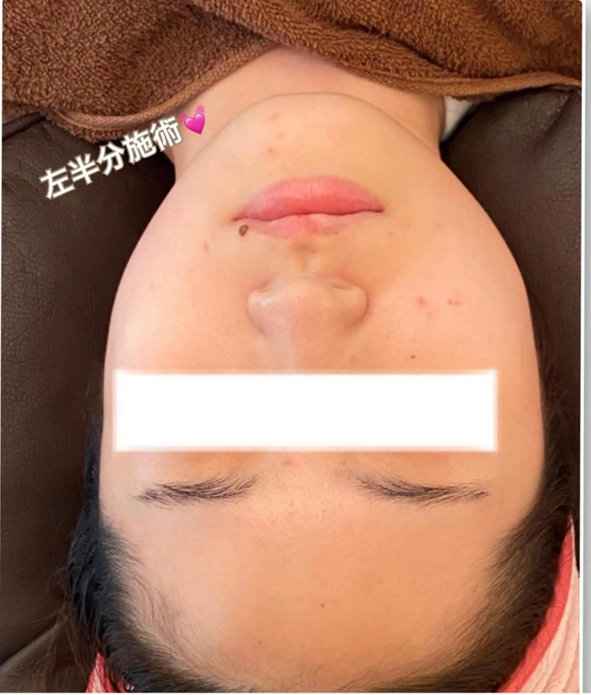 エステ FLEUR大阪・整体 ・ハイフ・痩身・小顔のエステ・リラクイメージ