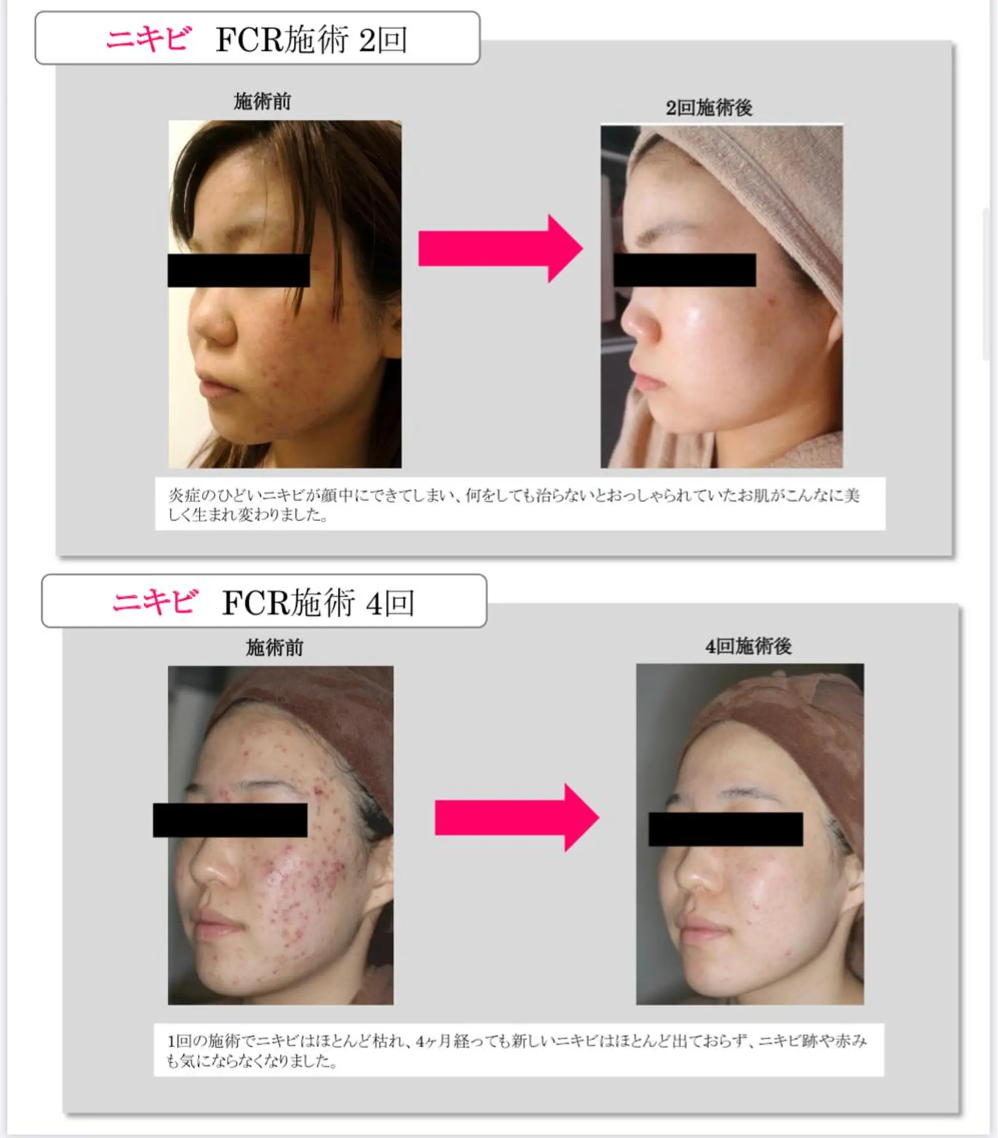 FLEUR大阪・整体 ・ハイフ・痩身・小顔のエステ・リラクイメージ