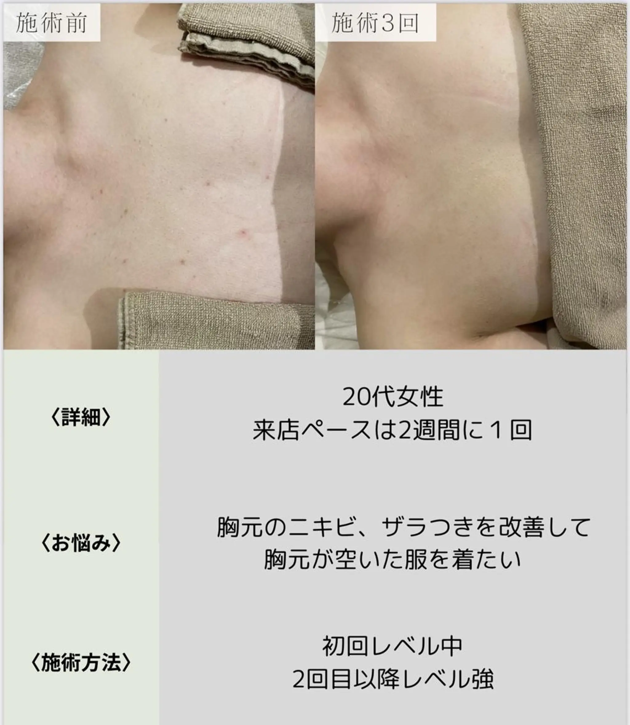 脱毛・眉毛・フェイス サロンN久留米店のその他イメージ