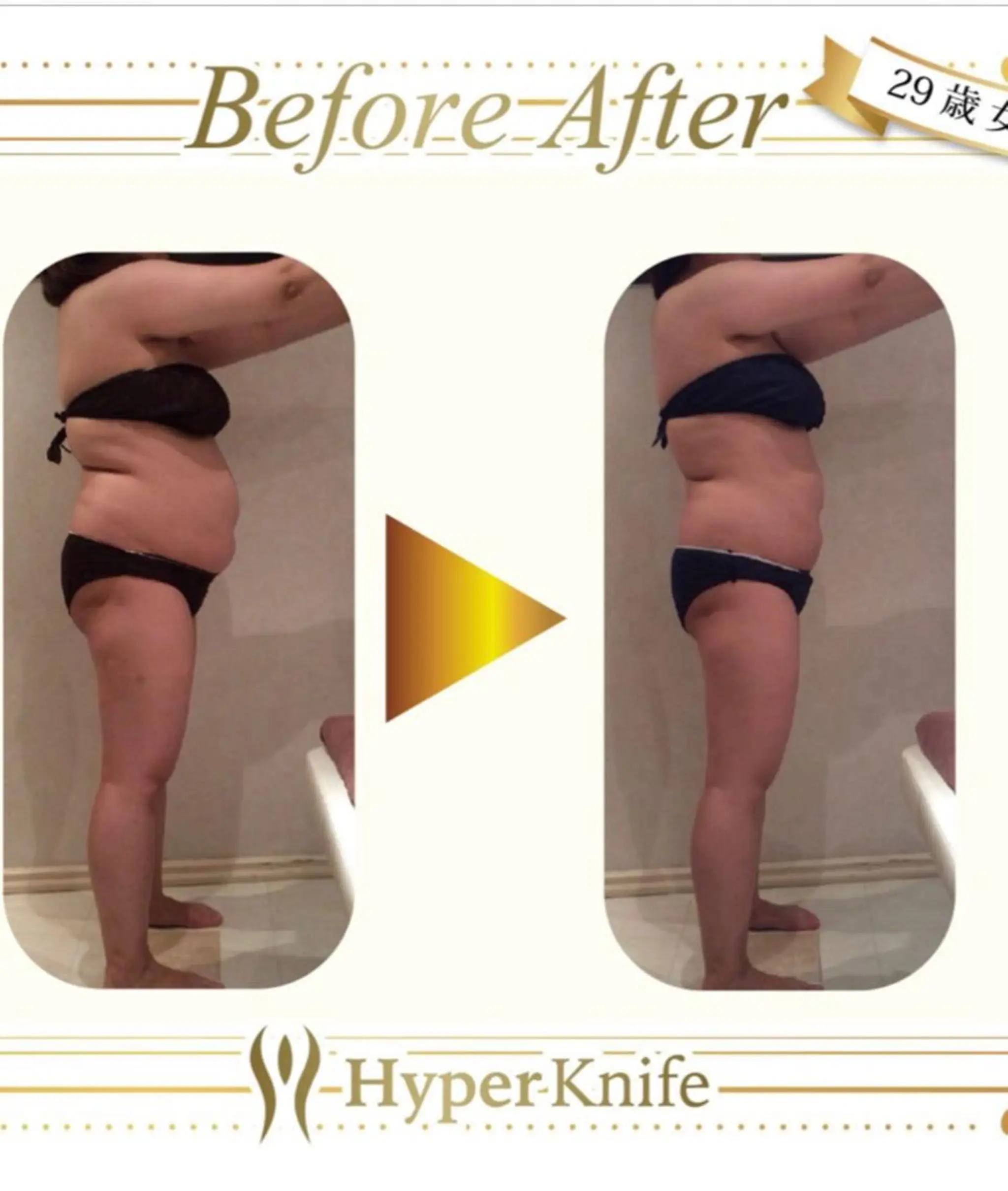 所沢痩身小顔コルギ AromaQueenのエステ・リラクイメージ