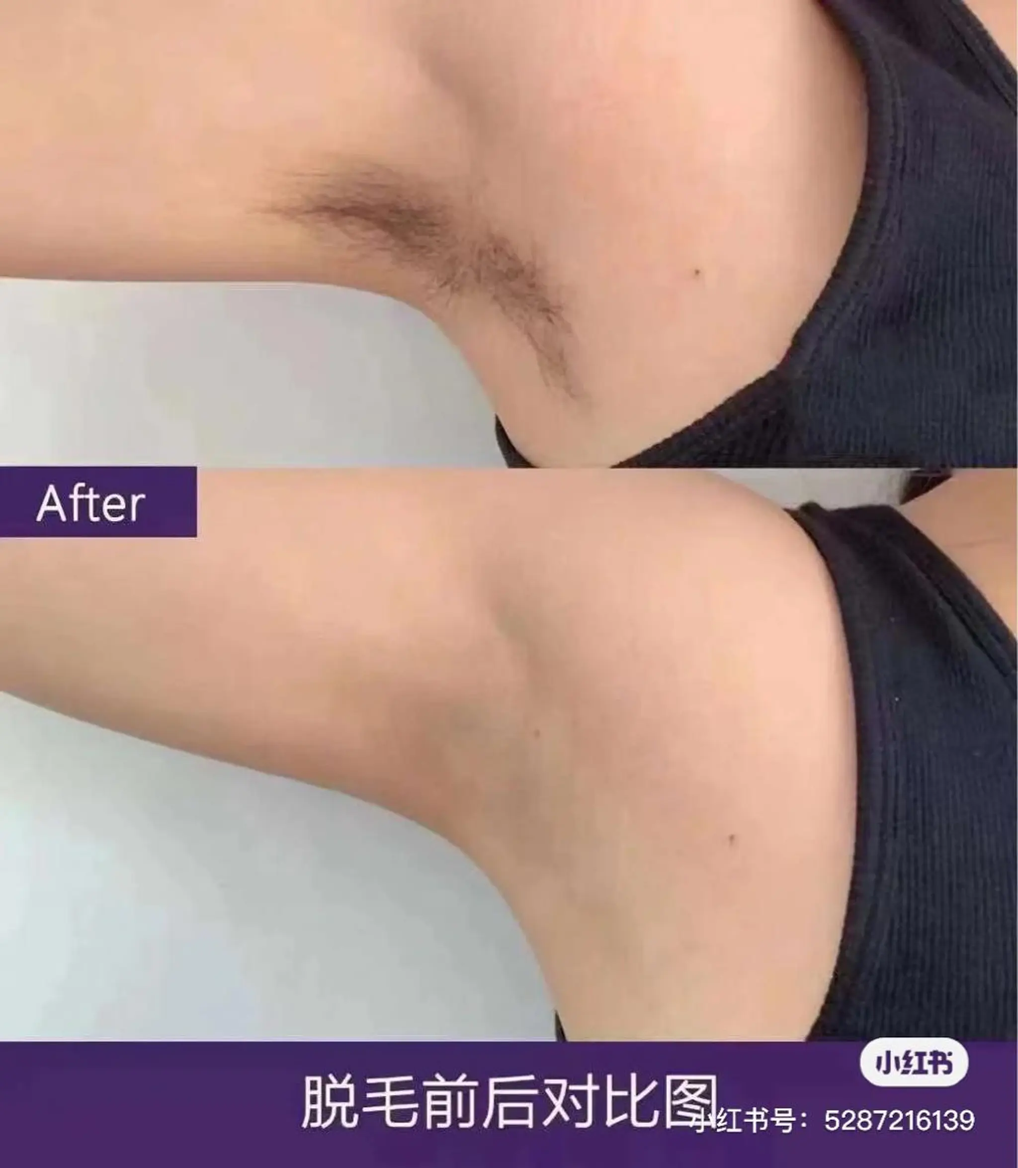 Einami 美肌痩身サロンのエステ・リラクイメージ