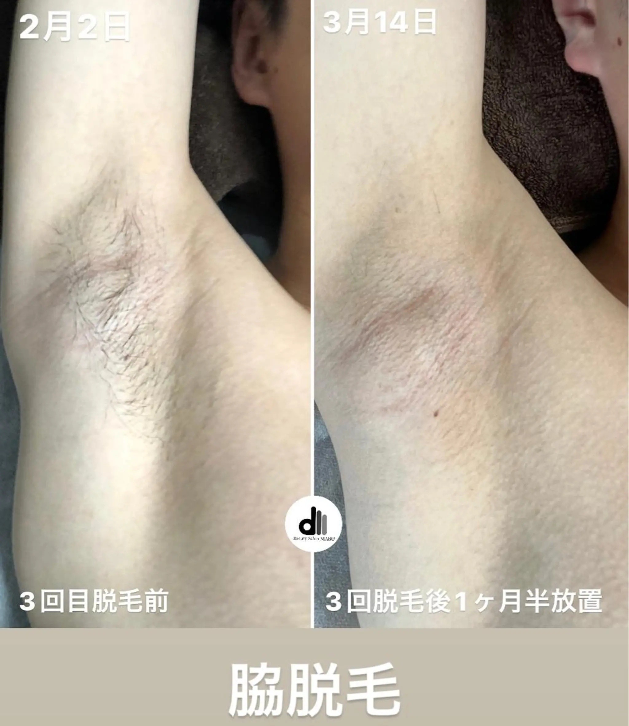 メンズ Beauty Salon MARU所属・新潟市メンズ【脱毛】 MARUのエステ・リラクイメージ