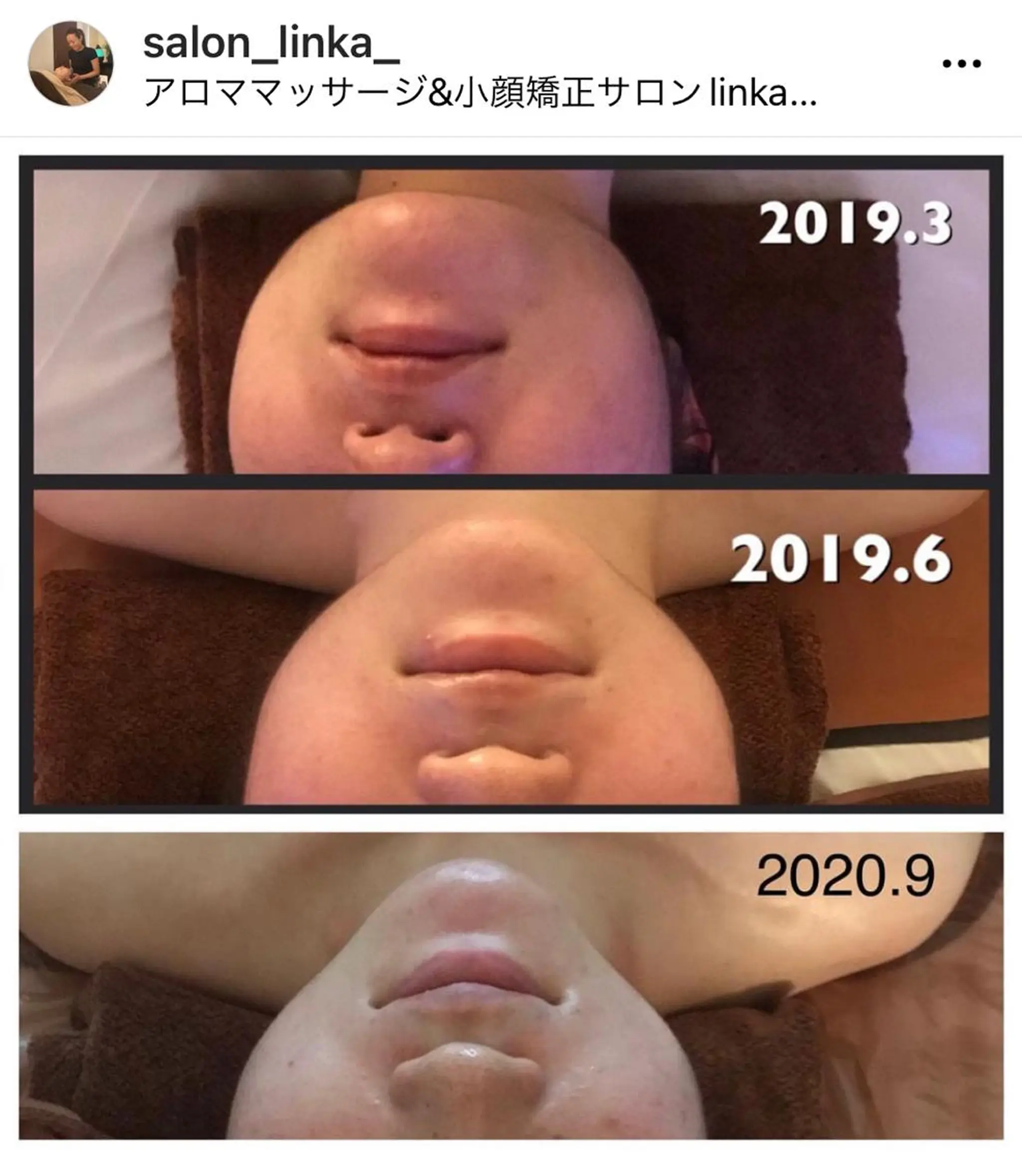 小顔コルギ＆よもぎ蒸しサロンLINKA所属・小顔＆美肌 サロンLINKAのエステ・リラクイメージ