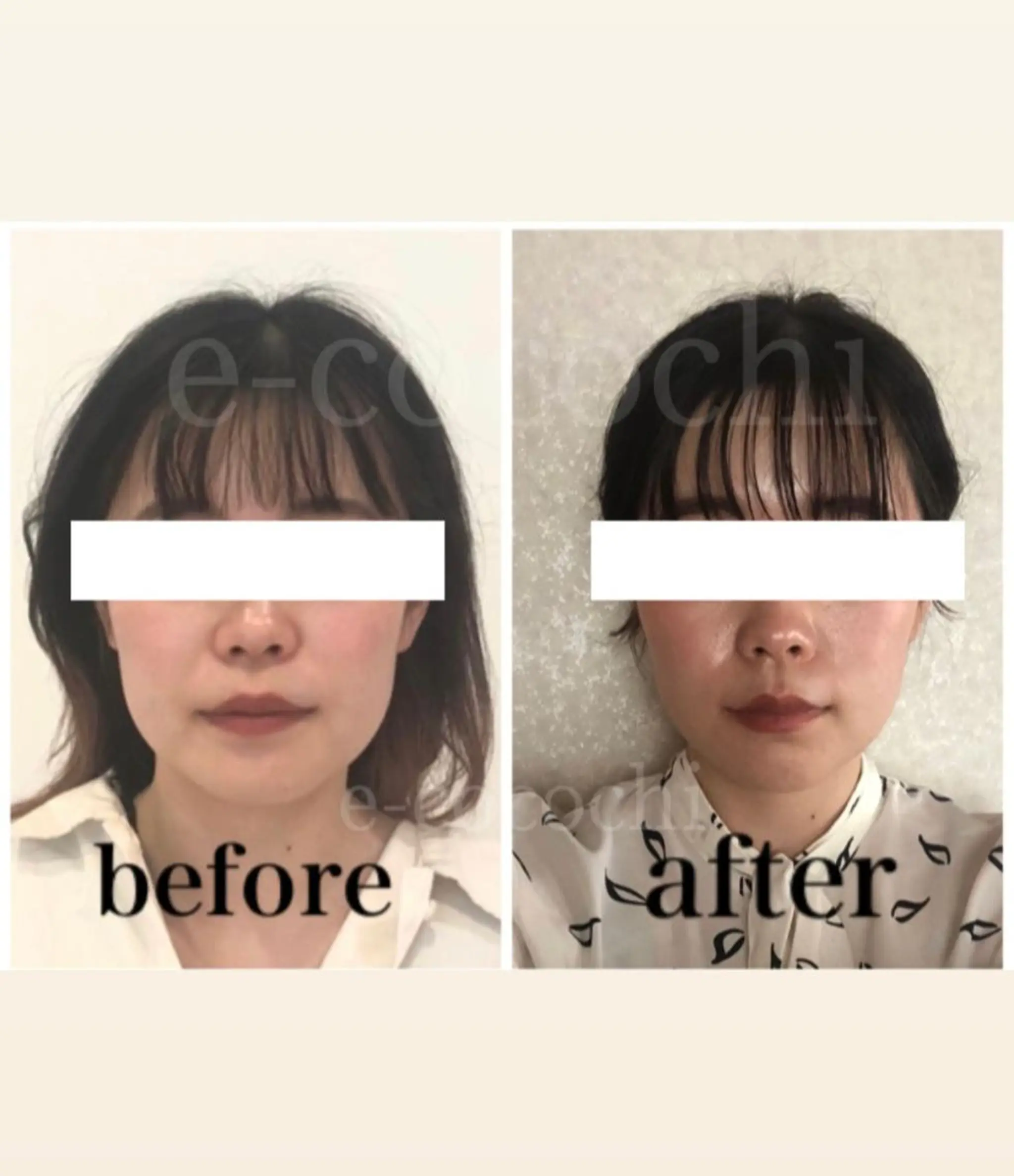 エステ リラク 小顔と ヘッドスパのお店のエステ・リラクイメージ