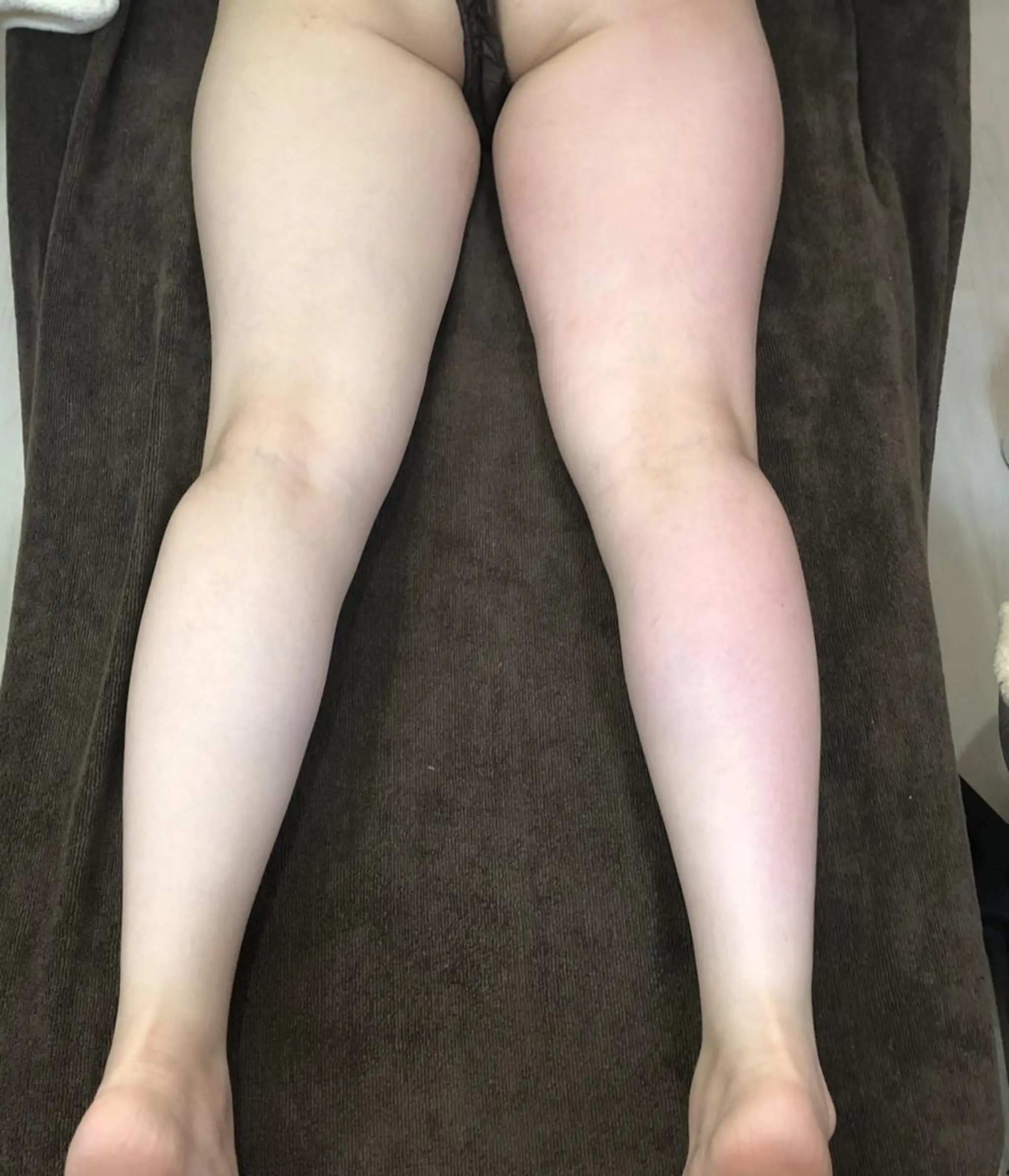 エステ OPREA 千種店のエステ・リラクイメージ