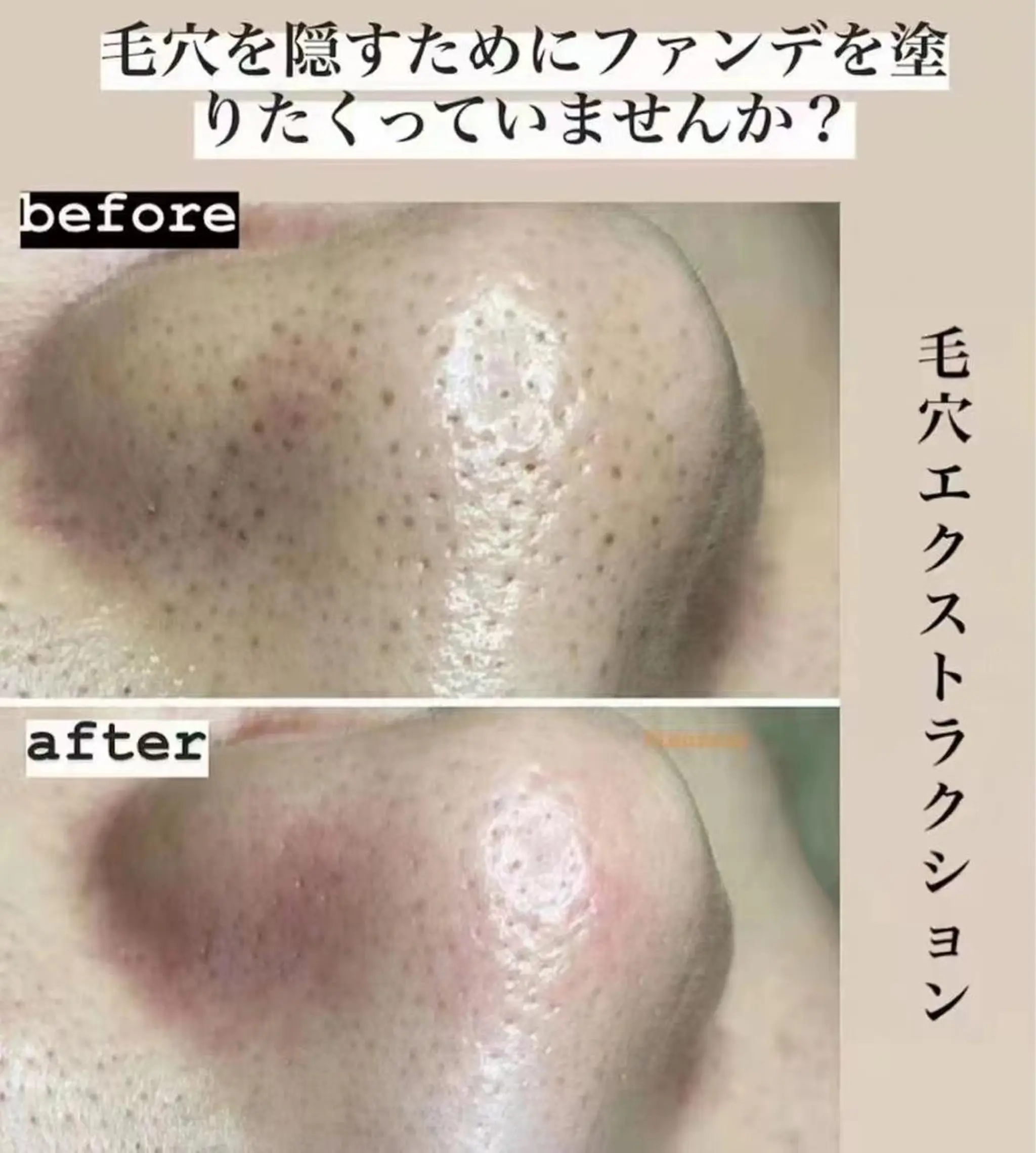 Einami 美肌痩身サロンのエステ・リラクイメージ