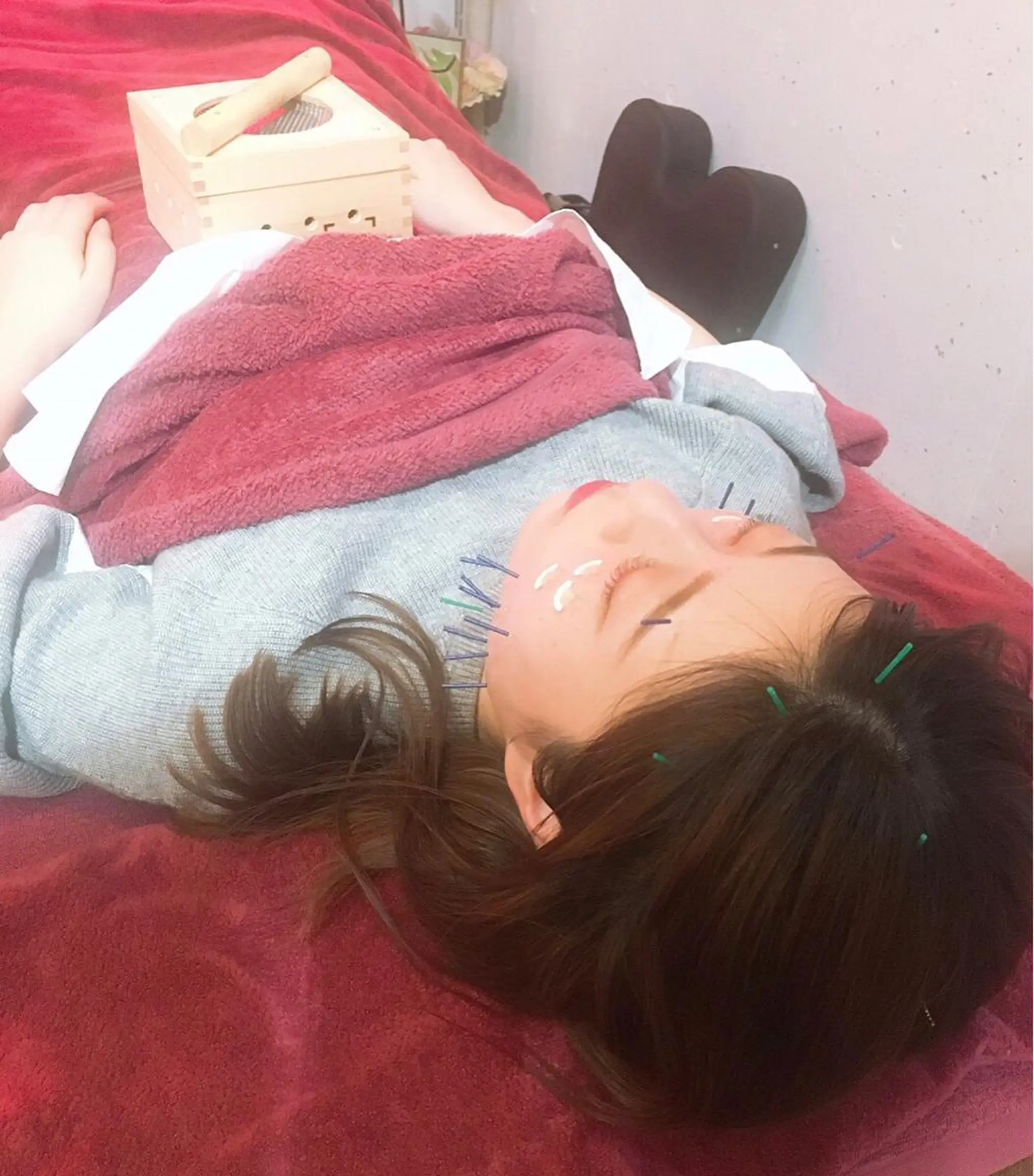 美容鍼灸女性専用 りんご鍼灸治療院のその他イメージ