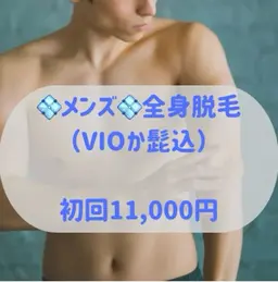 人気No. 1💠メンズ💠全身脱毛(VIOかヒゲどちらか選べます)✨境目なく全身ツルツルに✨
