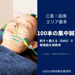 【🉐平日限定🉐】美容鍼(75分)※写真掲載+口コミご協力いただける方限定