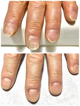 トラブルネイルケア(ハンド)メンズOK