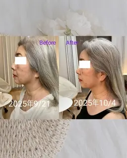 【むくみ顔改善】即美顔フェイシャル60分￥4400※SNS写真にご協力いただける方、2回来店可能な方