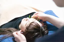 【ご新規様限定】美容鍼＋鍼灸整体をお得な価格で体験できます✨　60分¥5500→¥4500