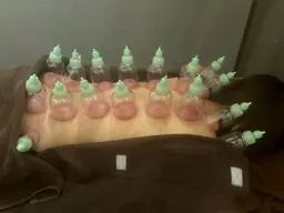 【女性限定】 疲労回復♪老廃物デトックス！Wカッピング+オイルトリートメント