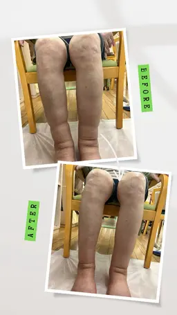 ♡フットセラピー♡ 高保湿オイルを使用し、第二の心臓ふくらはぎと足のアーチに特化したセラピー🦶浮腫スッキリ🍀