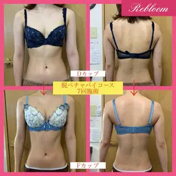 Sakurako式！脱ペチャパイコース（バストアップ）