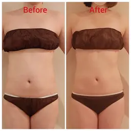 くびれ集中!浮き輪肉へアプローチ!話題の痩身マシーンでお腹&腰を徹底ケア☆