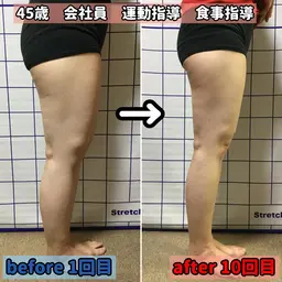 【太もも痩せ】ラジオ波&キャビ 短時間お得 所要30分