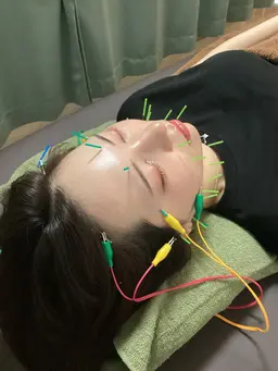 《美容鍼+整体》選べる施術つき120分コース