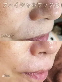 フェイシャルワックス