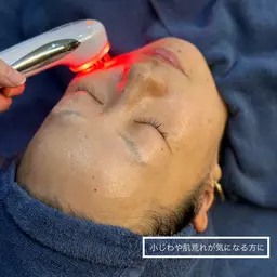 《ブライダル/美白ケア》【くすみ・乾燥・赤みが気になる方に!】ピーリング+光フェイシャル+エレクトロポレーション