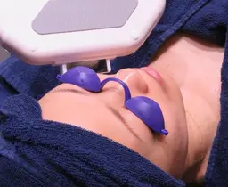 光フェイシャル(光のみ)