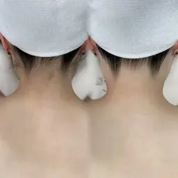 【 うなじ脱毛+シェービング 】後ろ姿美人へ🦢🏹