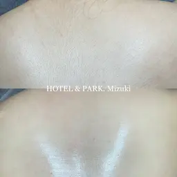 新生活に☀️【背中上*うなじ込+もみあげワックス脱毛】袴姿/成人式/ブライダル/前撮り前に◎