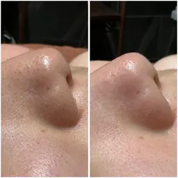 フェイシャル体験オーダーメイド90分