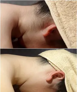 【着物やドレスを着る方！】うなじ美人に☆襟足・襟足横・背中上脱毛　5500円