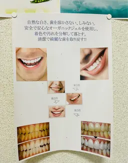 歯のホワイトニングセルフ