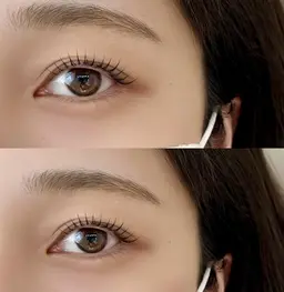 🐰全顔フェイスワックス脱毛🐰メンズも🆗