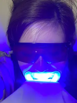 💠セルフホワイトニング💠 8分✖️2回コース