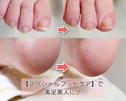 足の爪切り&足裏ふわふわケア