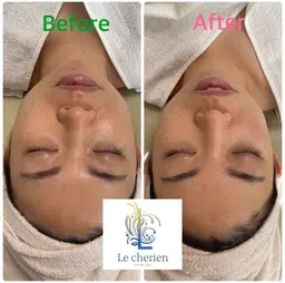 リフトアップコース