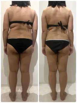 下半身痩身初回