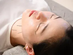 【🎉OPEN1周年🎉】電気美容鍼+小顔矯正のスペシャルセットメニュー。