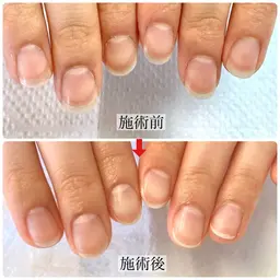 本格ネイルケア&ダイヤモンドトップコート