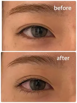 上下まつ毛パーマ［ラッシュリフト］+集中ダメージケアトリートメント付き🌿コーティング仕上げ