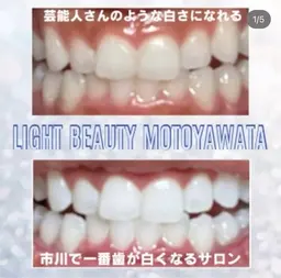 【平日限定】🦷通常お試し30分2,970円→2,470円
